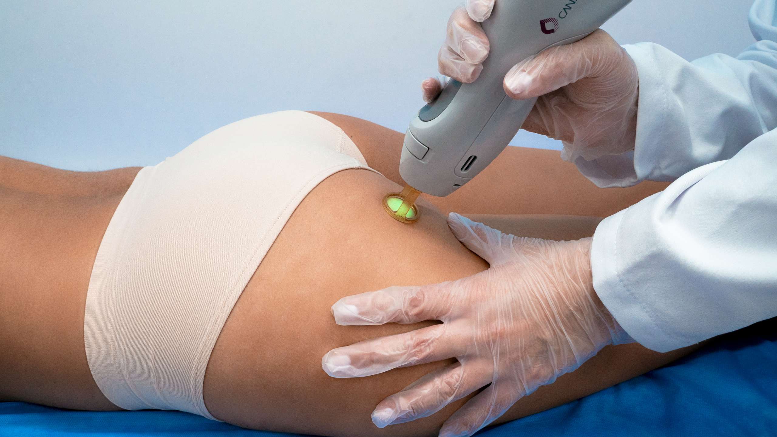 Depilacion laser en linea interglutea Una Guia Completa Espacolaser Colombia